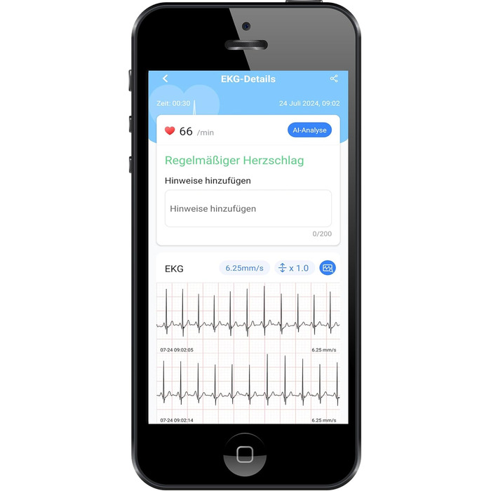 TIGA-MED Armfit Plus: тонометр на плече з Bluetooth, EKG-діагностика, монітор серцевого здоров'я, додаток для iOS та Android