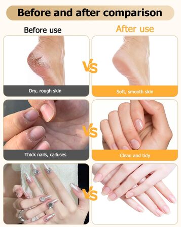 Набір для манікюру та педикюру з електричною насадкою для шліфування нігтів, 6 насадок, 20 шліфувальних кілець, 5 швидкостей, LED-підсвічуванням, білий