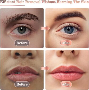 Електричний пристрій для видалення волосся на обличчі для жінок з LED-підсвічуванням, безболісний тример для обличчя, тіла, губ та підборіддя, білий