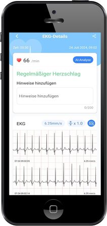 TIGA-MED Armfit Plus: тонометр на плече з Bluetooth, EKG-діагностика, монітор серцевого здоров'я, додаток для iOS та Android