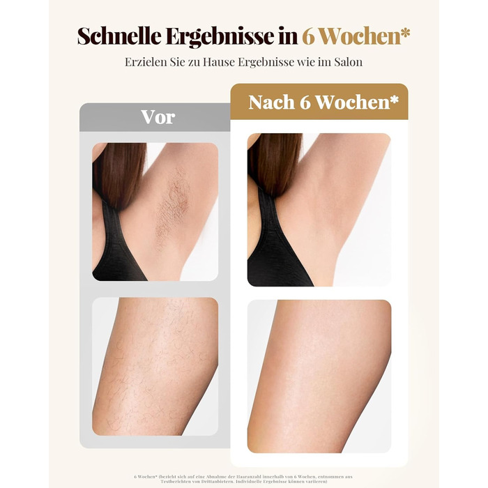 Пристрій для епіляції IPL Laser - Безболійний пристрій для видалення волосся IPL з 9 рівнями інтенсивності, 999,900 світлових імпульсів для дому, тіла, обличчя, зони бікіні та пахв (Бежевий)