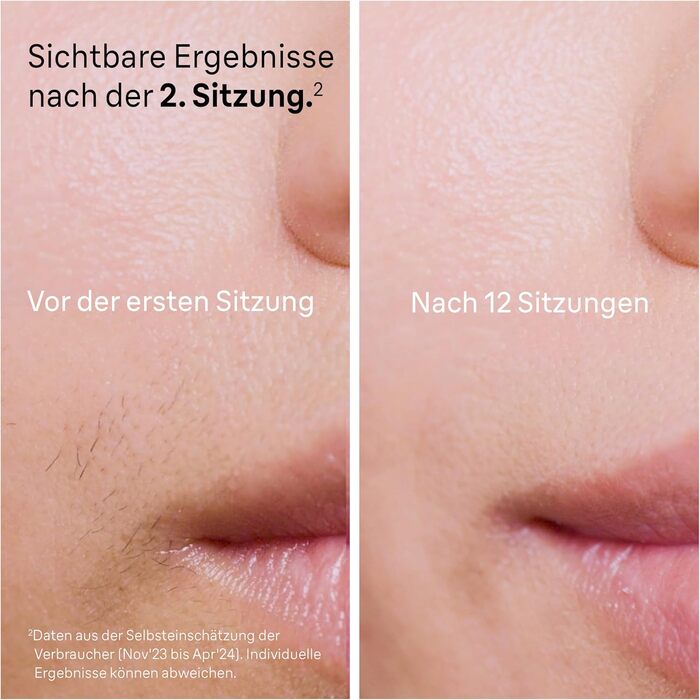 Braun Silk·expert Pro 5 IPL PL5157 – Апарат для епіляції в домашніх умовах, білий/золотий + Gillette Venus
