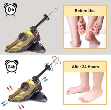 Halcent Shoe Stretcher for Men and Women 2-Way Shoe Stretcher Plastic & Metal Shoe Expander Shoe Width Adjuster for Adjustable Length and Width Shoe Stretcher with Shoehorn