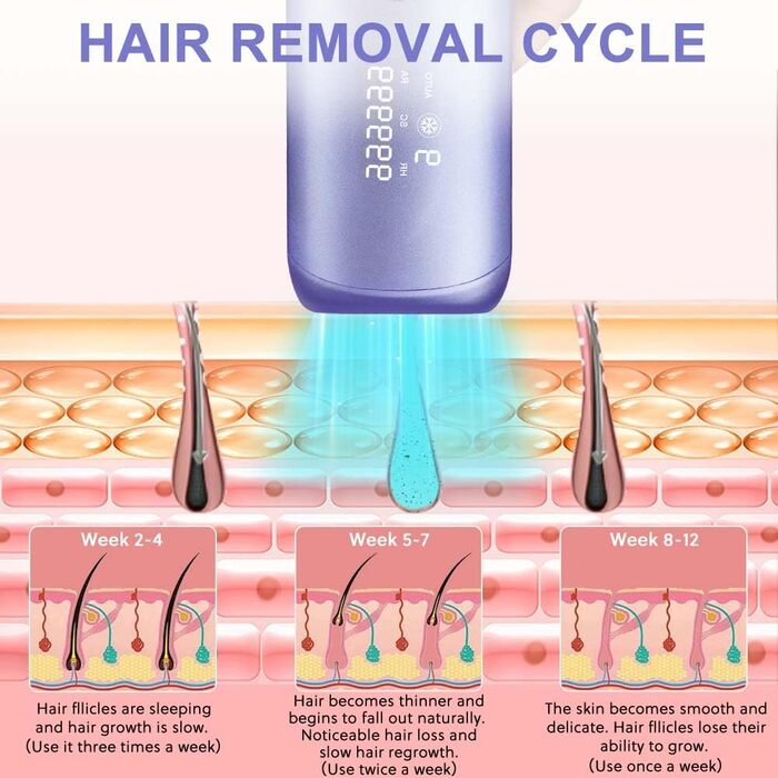 Епілятор ACWOO з системою охолодження, безболісне видалення волосся, лазерний епілятор з 3 функціями HR/SC/RA, 9 рівнів потужності для жінок/чоловіків, обличчя, руки, зона бікіні, тіло, ноги, білий (фіолетовий)
