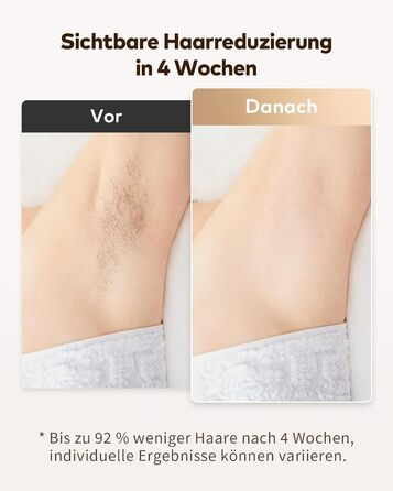 Пристрій для епіляції IPL Haarlosy 3-в-1: HR/SC/RA, 999 900 імпульсів, 9 рівнів енергії, безболісна епіляція для чоловіків та жінок, для тіла