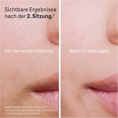 Braun Silk·expert Pro 5 IPL PL5157 – Апарат для епіляції в домашніх умовах, білий/золотий + Gillette Venus