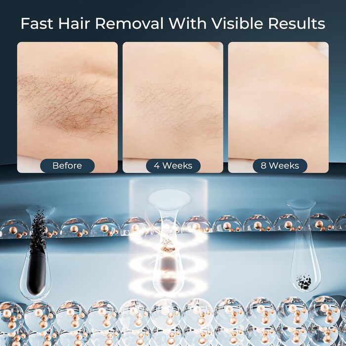 Пристрій для епіляції IPL 21J: Лазерний епілятор з 9 рівнями та червоним світлом 600 нм, 999,900 імпульсів для дому - для жінок та чоловіків, для обличчя, тіла, зони бікіні та ніг