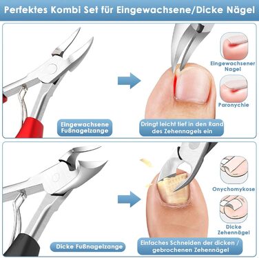 Набір професійного догляду за нігтями Modacraft: 7 шт. для видалення врослих, твердих та пошкоджених нігтів. Pedikюрний набір з високоякісної нержавіючої сталі.