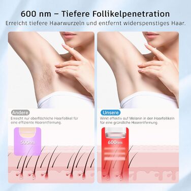 Пристрій для епіляції IPL з лазером та охолодженням, необмежена кількість імпульсів, довжина хвилі 600 нм, для жінок та чоловіків, обличчя, бікіні, руки, ноги, тіло, Rose