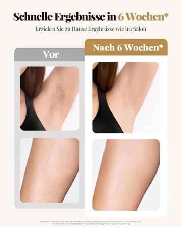 Пристрій для епіляції IPL Laser - Безболійний пристрій для видалення волосся IPL з 9 рівнями інтенсивності, 999,900 світлових імпульсів для дому, тіла, обличчя, зони бікіні та пахв (Бежевий)