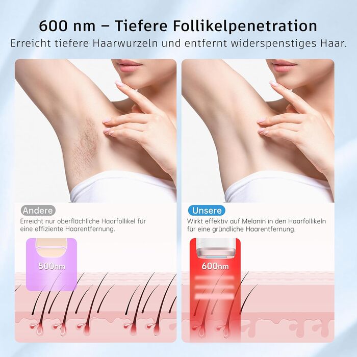 Пристрій для епіляції IPL з лазером та охолодженням, необмежена кількість імпульсів, довжина хвилі 600 нм, для жінок та чоловіків, обличчя, бікіні, руки, ноги, тіло, Rose