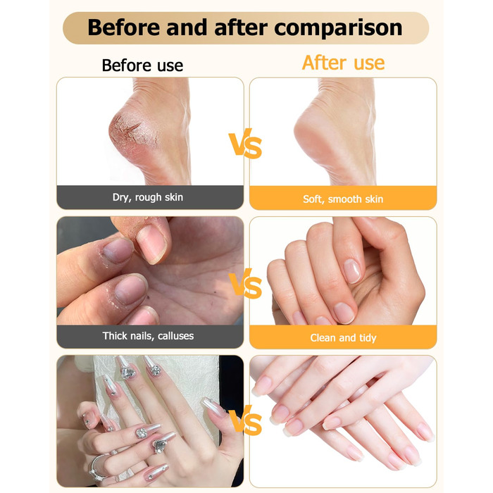 Набір для манікюру та педикюру з електричною насадкою для шліфування нігтів, 6 насадок, 20 шліфувальних кілець, 5 швидкостей, LED-підсвічуванням, білий